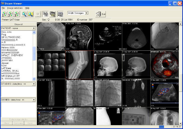 download the last version for iphoneLim DICOM Viewer