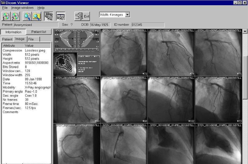 download the last version for android Sante DICOM Editor 8.2.5