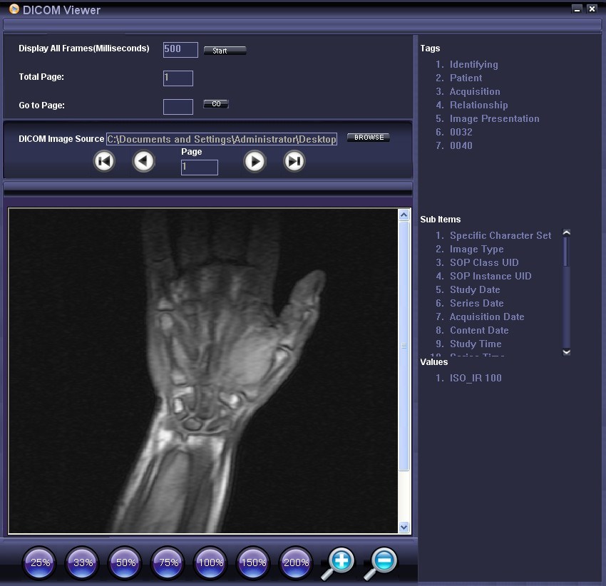 download the new for windows Sante DICOM Viewer Pro 12.2.5