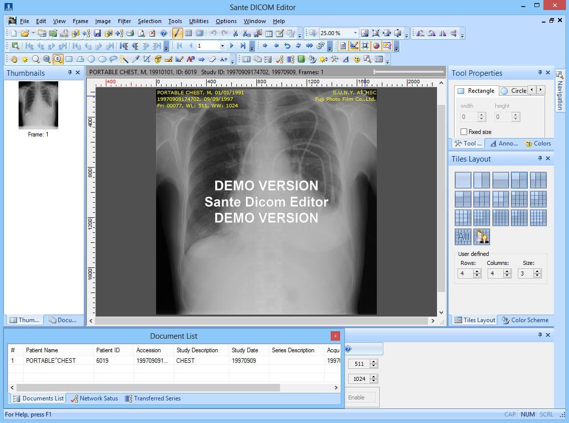 Sante DICOM Viewer Pro 12.2.5 download the new version for android