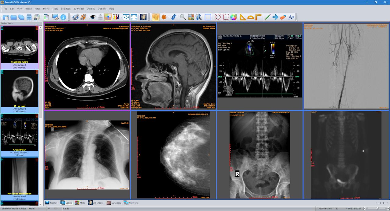 instal the last version for android Sante DICOM Viewer Pro 12.2.5