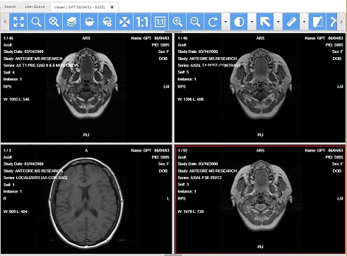 free dicom viewer ant